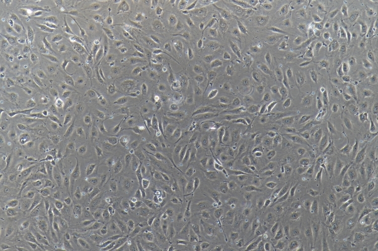 huvec 人脐静脉内皮细胞系huvec