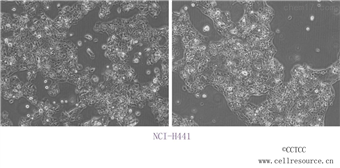 人肺腺癌細胞 STR鑒定  安為生物